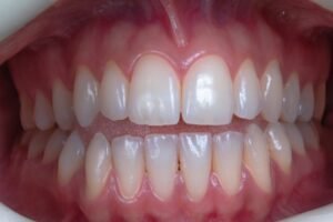 Identifying Early Signs of Gum Disease for Effective Treatment